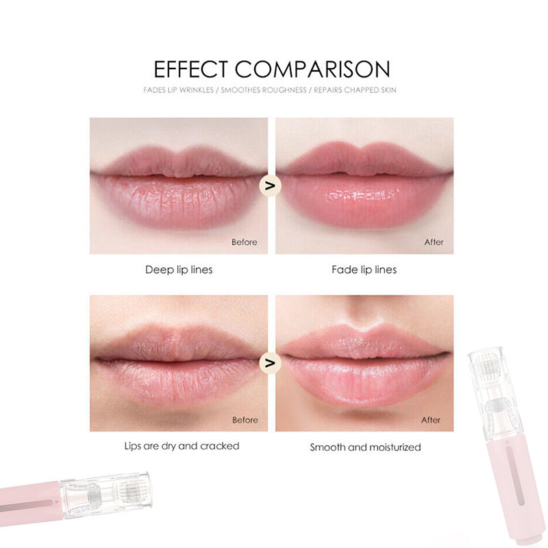 π LIPBOOSTβ’ - The Next-Gen Lip Revitalizing Roller